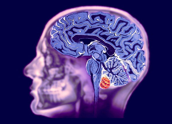 МРТ головного мозга: показания к проведению, особенности процедуры и ее стоимость 