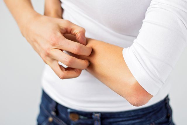 Аллергия на руках: причины появления и методы лечения 