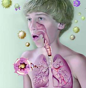По каким признакам распознать начало бронхиальной астмы 