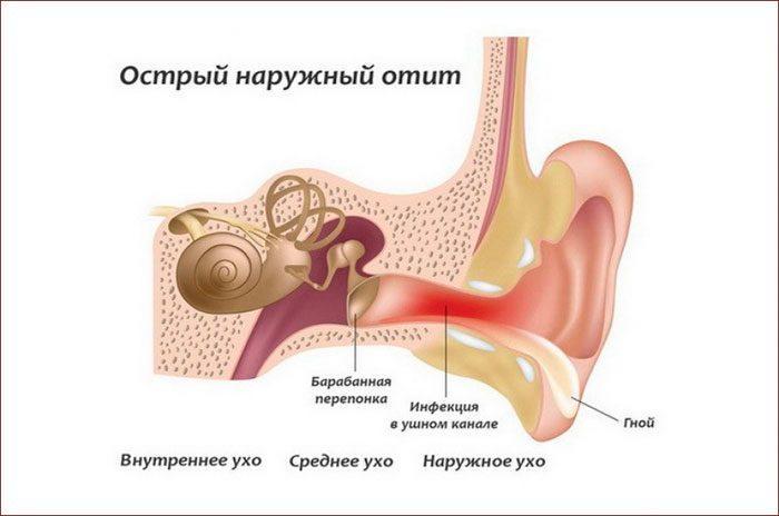 Причины возникновения шума в области правого уха 