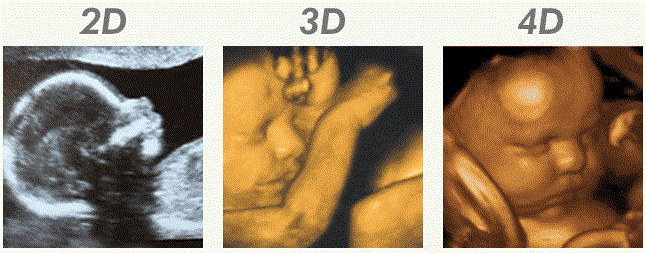 Что такое 3Д УЗИ при беременности, фото, отзывы, цены. Когда и на каком сроке лучше делать 3Д УЗИ при беременности 