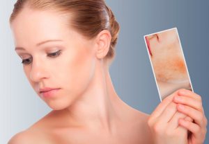 Чем лечить кожный дерматит 