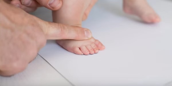 Что делать при появлении бородавок у детей на ногах? 