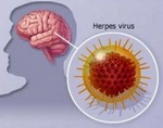 Что такое гepпeсный энцефалит и как его лечить — полная клиническая картина гepпeса головного мозга 