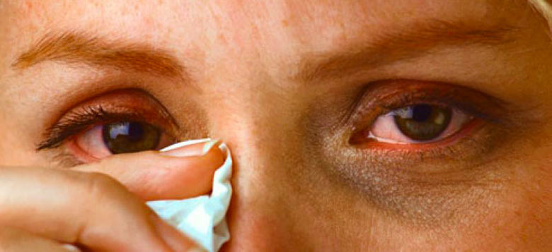 Герпес под глазом: причины появления и методы лечения 