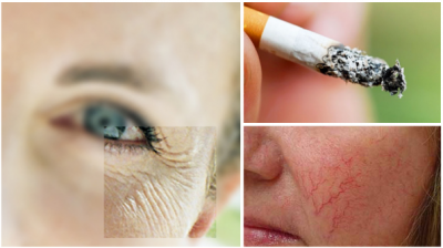 Как курение влияет на кожу лица 