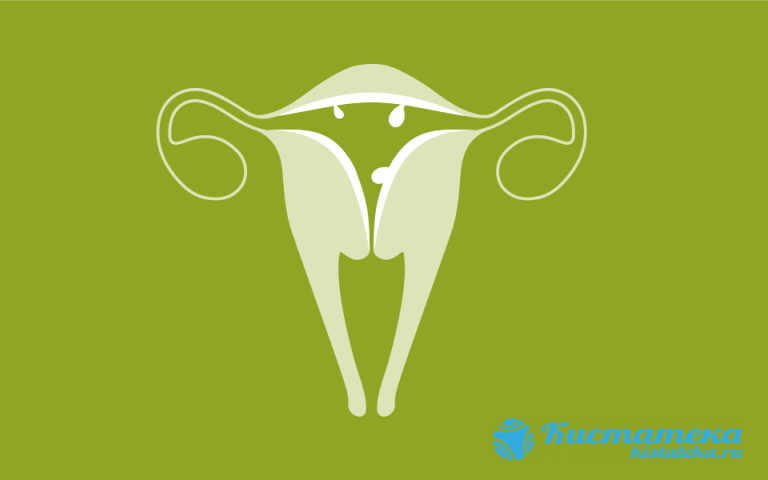 Аденома у женщин: матки, яичников и молочной железы 