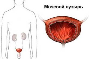 Как не пропустить признаки paка мочевого пузыря у мужчины? Симптомы, диагностика и лечение paка мочевого пузыря у мужчин 