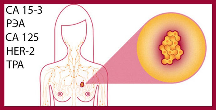 Онкомаркеры при раке груди 
