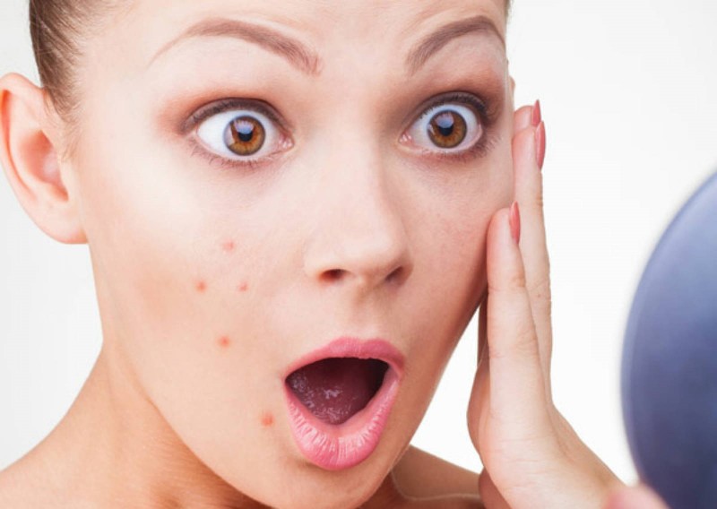 Заболевания кожи: как распознать и вылечить? 