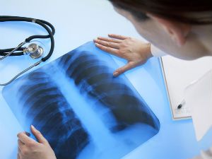 Насколько вреден рентген и чем он опасен? 