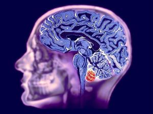 Вредно ли МРТ головного мозга? 