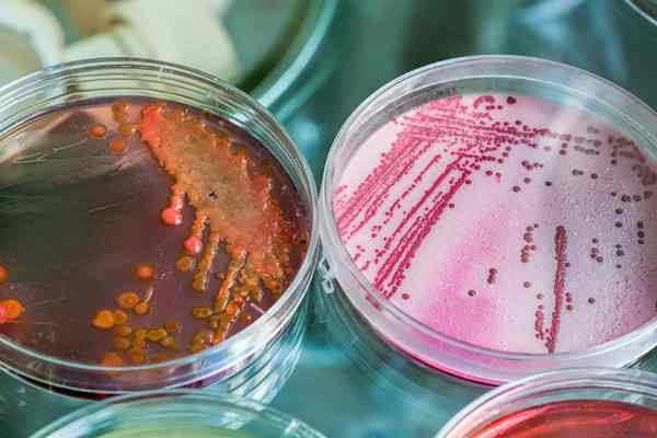 Бак посев уреаплазмы с расшифровкой и устойчивостью к антибиотикам 