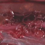 Опасные паразиты в печени человека: первые симптомы и лечение 