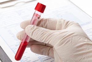 Анализ крови на описторхоз — подготовка, процедypa, расшифровка и лечение паразитарного заболевания 