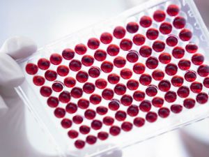 Расшифровка анализа крови на антитела 