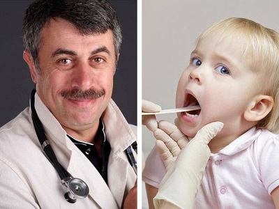 Как лечить ларингит у ребенка по методу доктора Комаровского 
