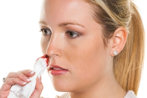 Как остановить кровотечение из носа, профилактика повторного 
