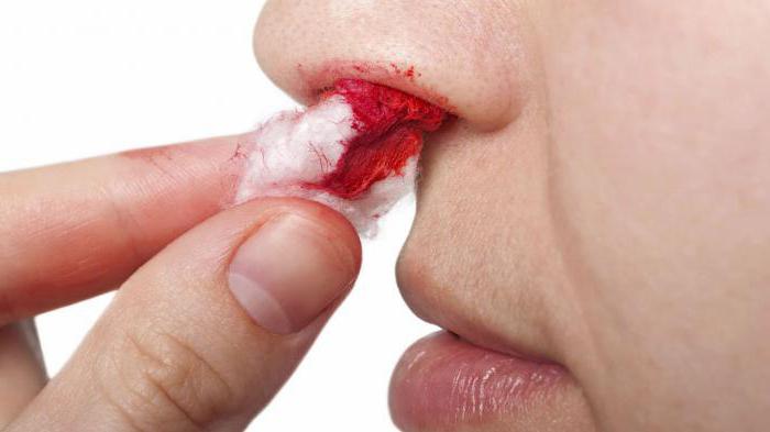 Как сделать так чтобы из носа пошла кровь? 
