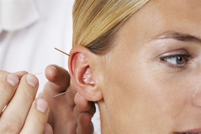 Методы стимуляции акупунктурных точек на ушах 