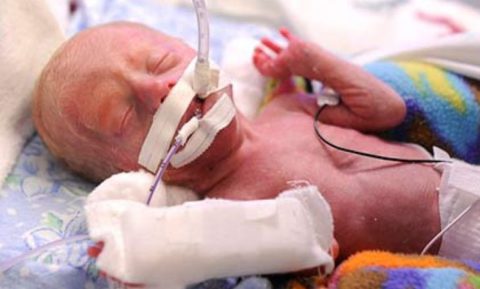 Пневмотоpaкс у новорожденных: приговор или решаемая проблема? 