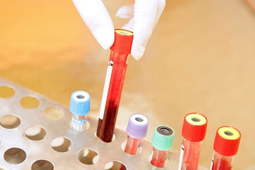 Анализ крови на АЧТВ при беременности — особенности и расшифровка 