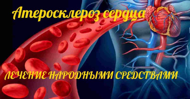 Атеросклероз сонной артерии лечение народными средствами 
