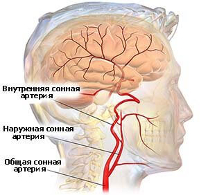 Сонная артерия: анатомия, функции, возможные патологии 