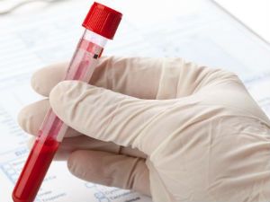 Тромбокрит — расшифровка РСТ в анализе крови 