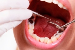 10 лучших способов отбеливания зубов в домашних условиях 