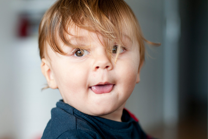 Анкилоглоссия или короткая уздечка языка у ребёнка 