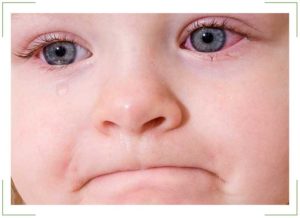 Беда или просто пустяк: почему у ребенка красные глаза? Причины подобных симптомов 