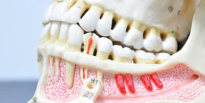Болезни зубов: виды, названия, причины и лечение зубных заболеваний 
