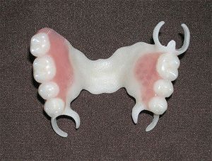 Достоинства и недостатки зубных протезов из полиуретана 