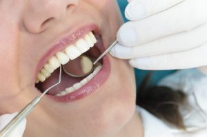 Физиотерапия в стоматологии: для зубов и десен 