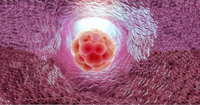 Имплантация эмбриона Сроки, условия и признаки 
