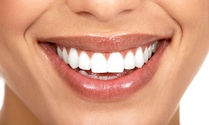 Как выровнять зубы без брекетов в домашних условиях? 