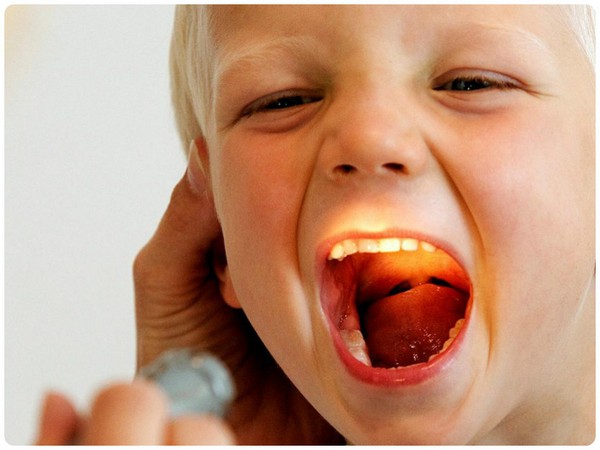 Как быстро вылечить горло у ребёнка от 3 до 5 лет 