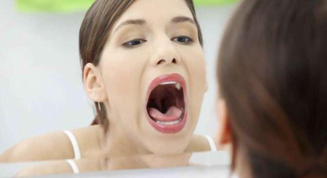 Как избавиться от язв во рту у взрослых: причины, лечение и фото 