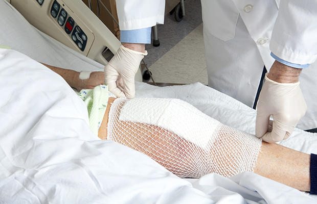 Инструкция по реабилитации после эндопротезирования коленного сустава 