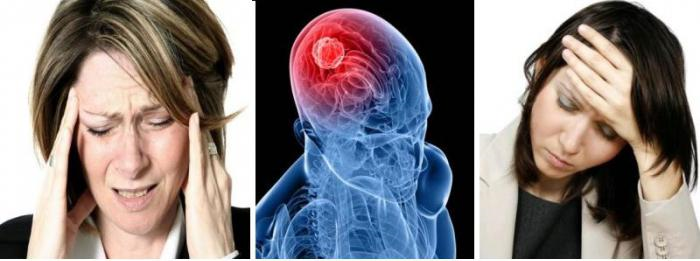 Как болит голова при опухоли головного мозга 