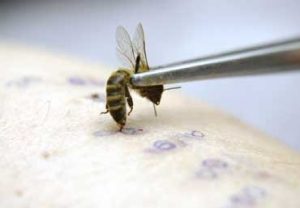 Как лечиться укусами пчел в домашних условиях 