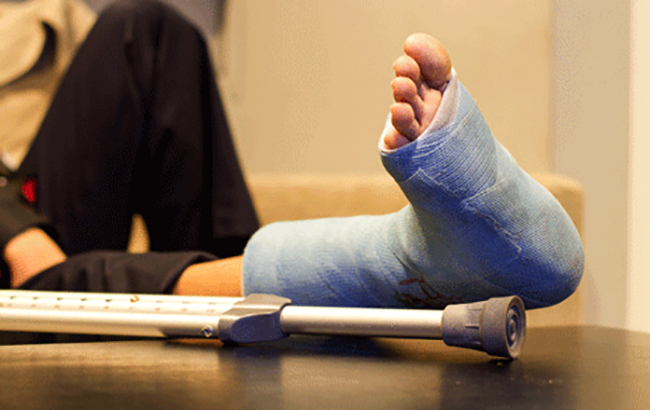 Как разpaбатывать ногу после перелома голеностопа 