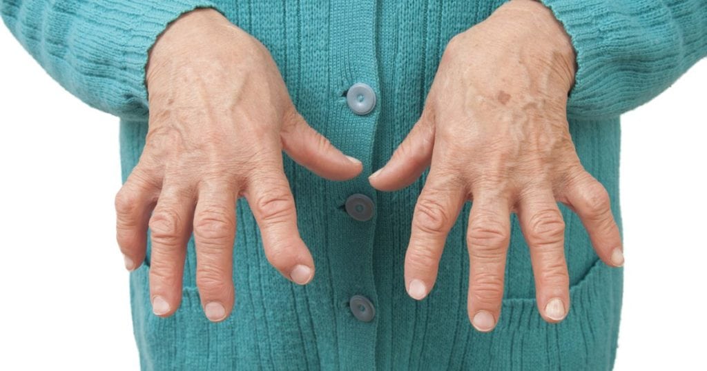 Как выявить ревматоидный артрит пальцев кистей рук на первых стадиях? 