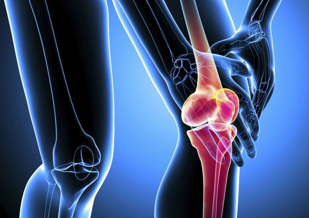 Код по мкб 10 артрит коленного сустава 