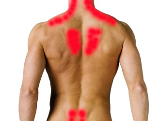 Лечение Миозита мышц спины 