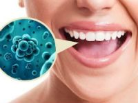 Симптомы и лечение дисбактериоза полости рта 