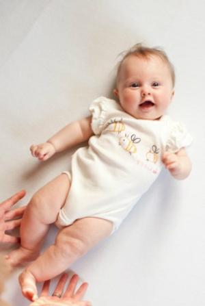 Кривошея у новорожденных: фото, массаж, лечение, причины 