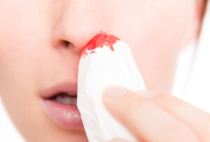 Кровь из носа при беременности: причины и лечение 