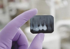 Можно ли делать рентген зуба при беременности 